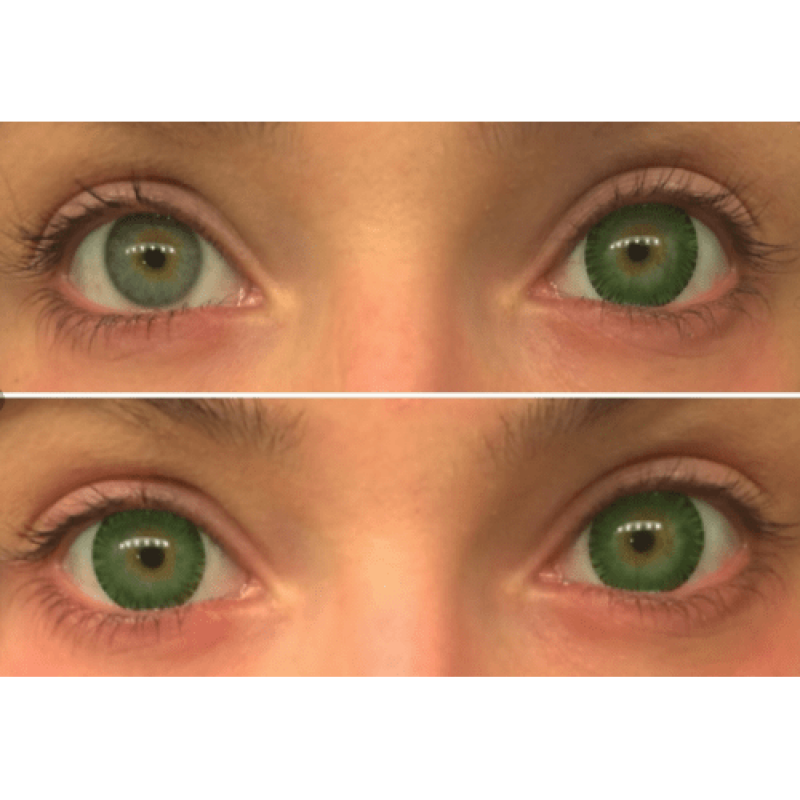 Контактні Лінзи Зелені - Грін2